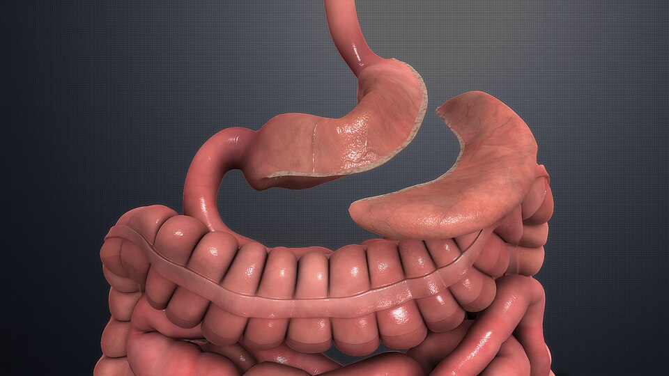 Sleeve Gastrectomy (Gastric Sleeve Surgery)